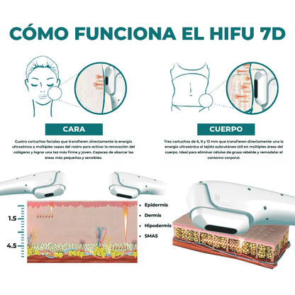 HIFU 7D + Liposonix + Radiofrecuencia Fraccionada RS F58