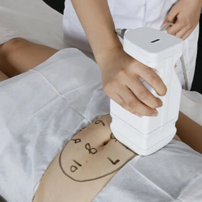 HIFU 7D + Liposonix + Radiofrecuencia Fraccionada RS F58