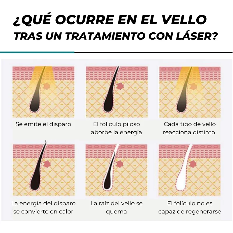 Qué ocurre en el vello tras un tratamiento con láser