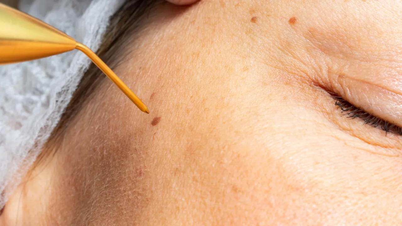 ¿Cómo funciona el Plasma Pen?